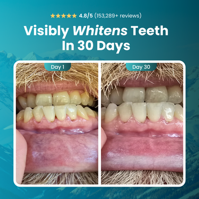 Noverla™ Remineralizing Gum